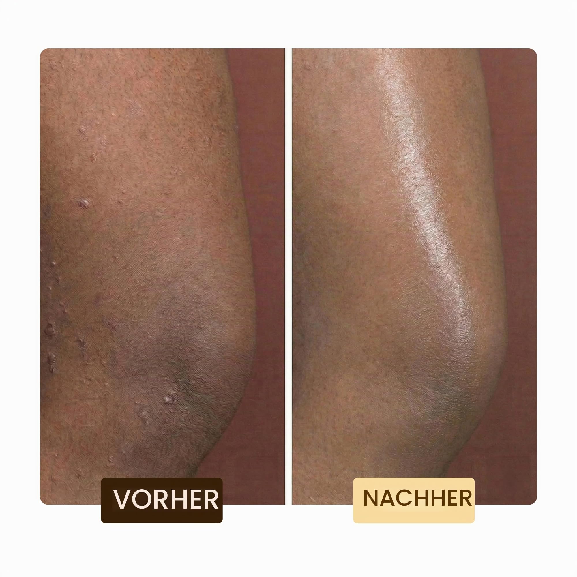 Makari Exklusiv Aktiv Intensiv Toning Glycerin 16.8oz - Haut Aufhellung & Aufhellung Feuchtigkeitscreme für Körper mit Organicarine™ - Whitening Behandlung für dunkle Markierungen & Altersflecken