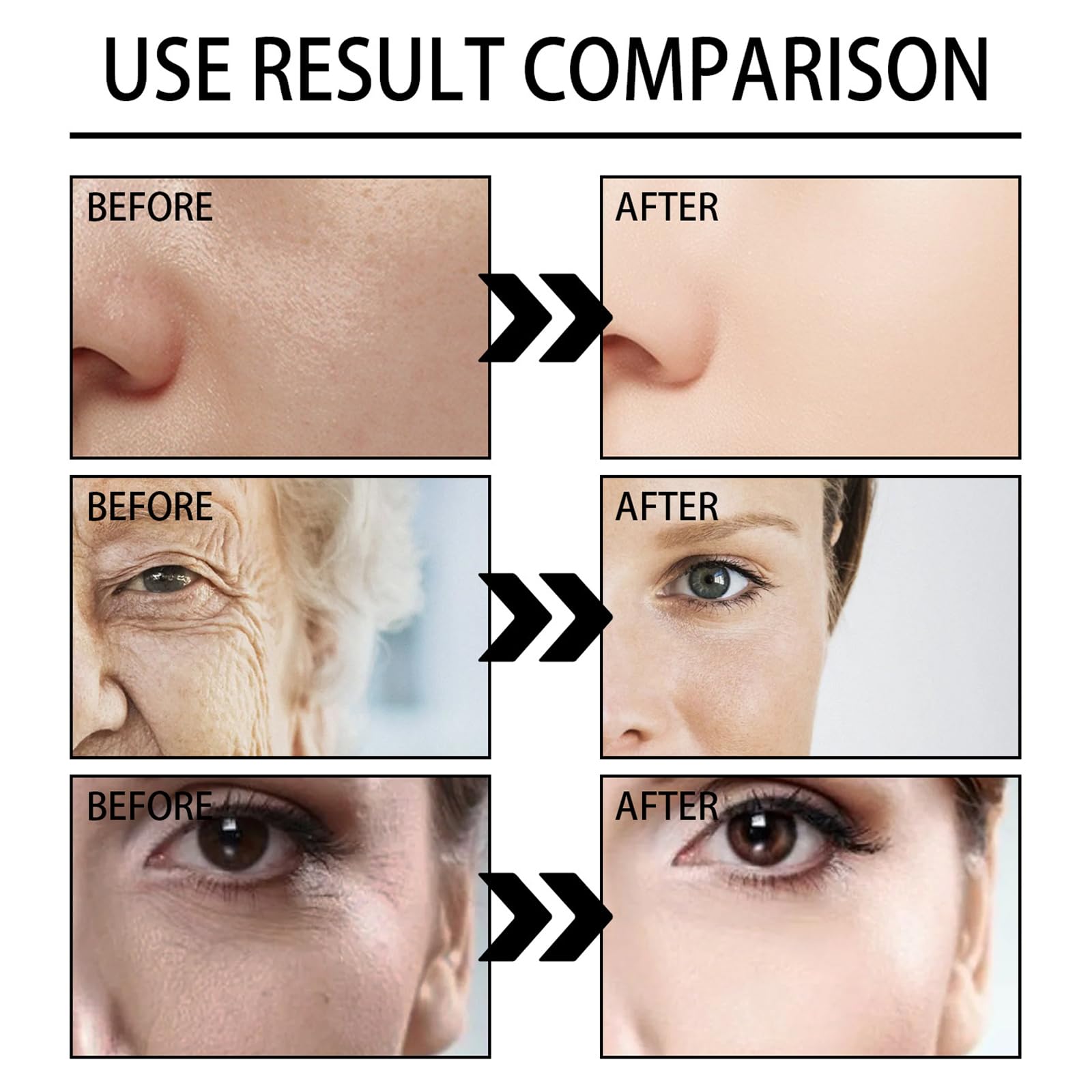 glutathione before surgery Glutathione Injections: Cost, Benefits and Side Effects