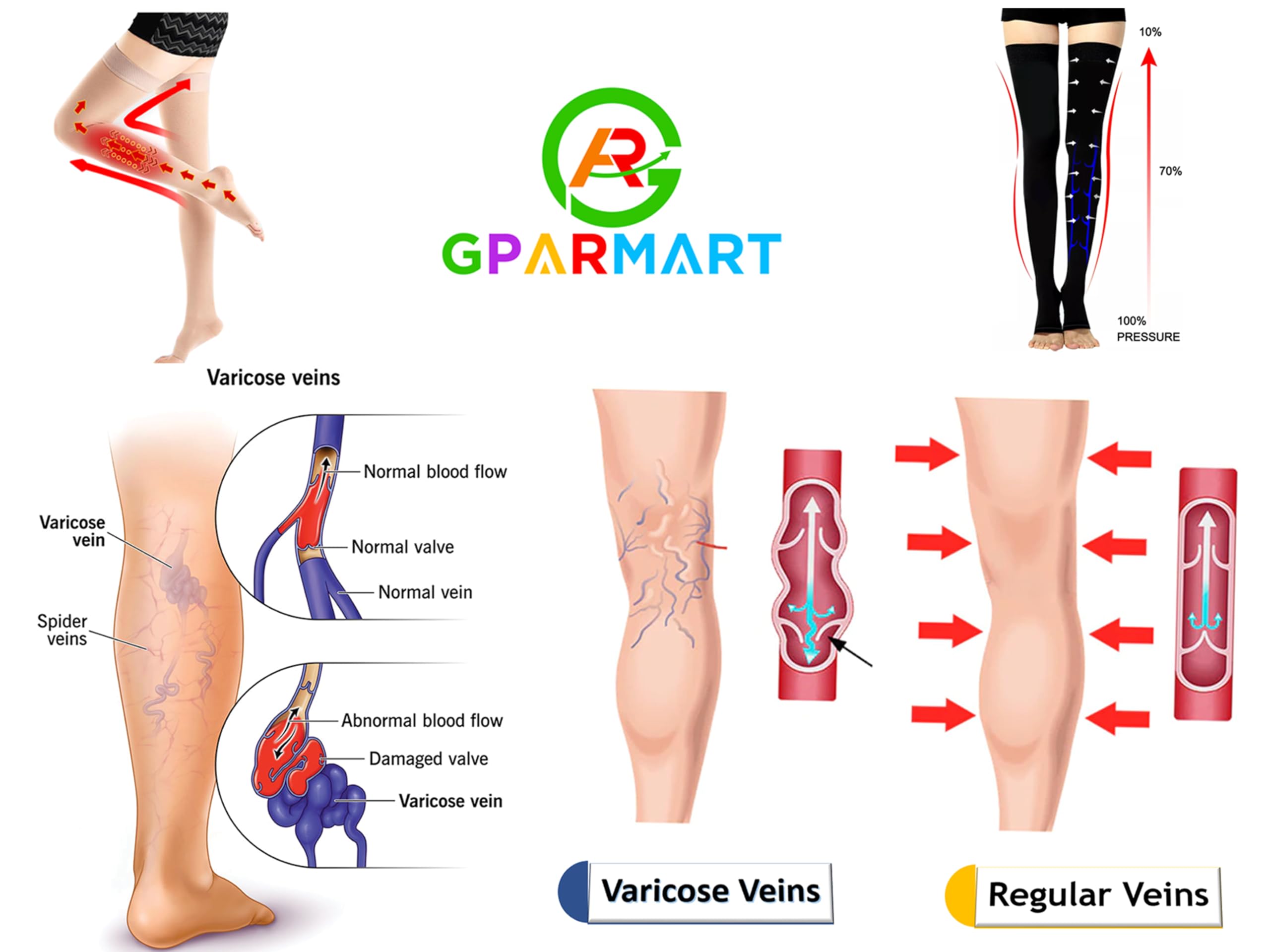 GPAR PREMIUM Bas de contention Médicale Classe 2, 23-32 mmHG, Bout Ouvert- Bas de cuisse pour Varices, Oedèmes, Douleurs aux jambes, pieds enflés, Varicosités-Unisexe