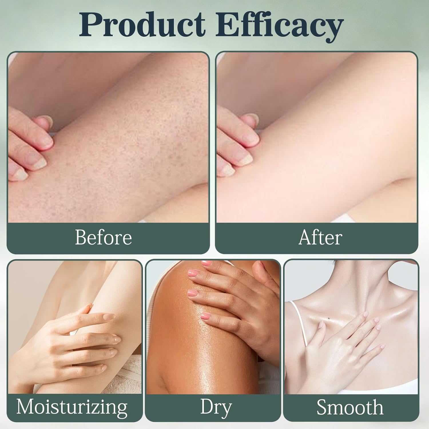 2PCS Intertrigo Cream – Skin Fold Care & Chafing Support Cream, Supports Skin Comfort, Fast-Drying Non-Greasy Formula for Daily Use - Image 8