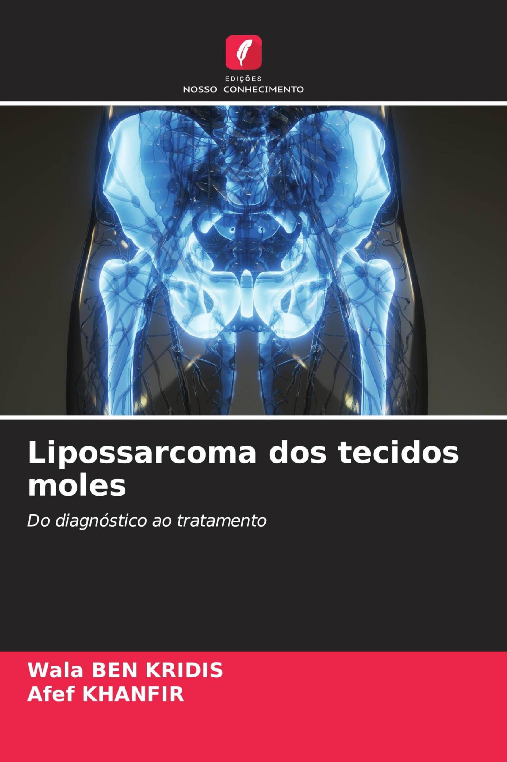 Lipossarcoma dos tecidos moles: Do diagnóstico ao tratamento