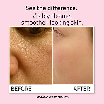 YEOUTH Dead Sea Mud Mask for a Visibly Purified and Refreshed-Looking Skin | Mud Face Mask With Hyaluronic Acid, Aloe Vera and Avocado, Deep-Cleansing Face Mask for Smoother Looking Skin, 8oz
