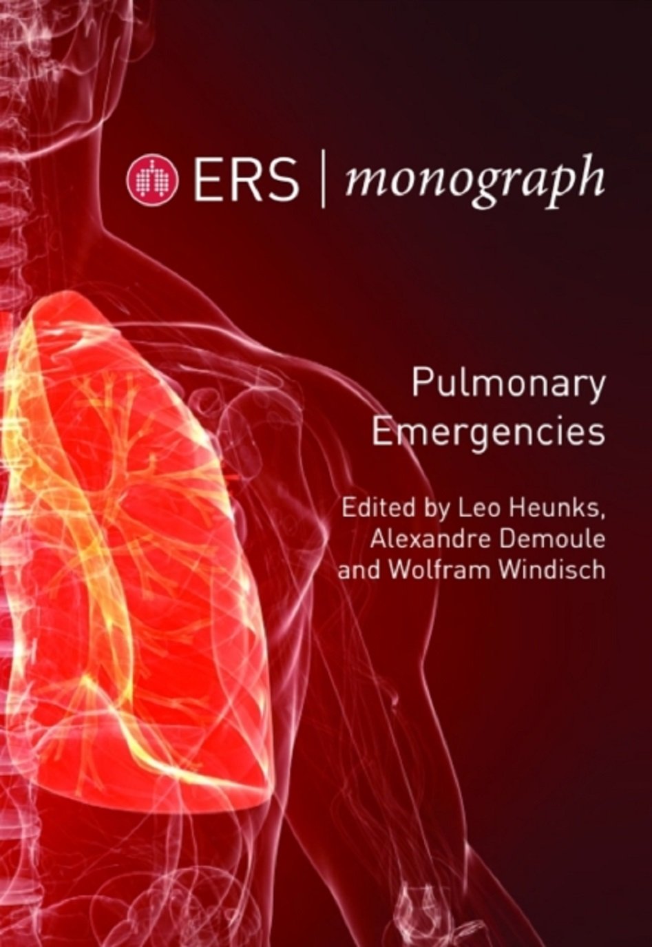 Pulmonary Emergencies (ERS Monograph) (English Edition)
