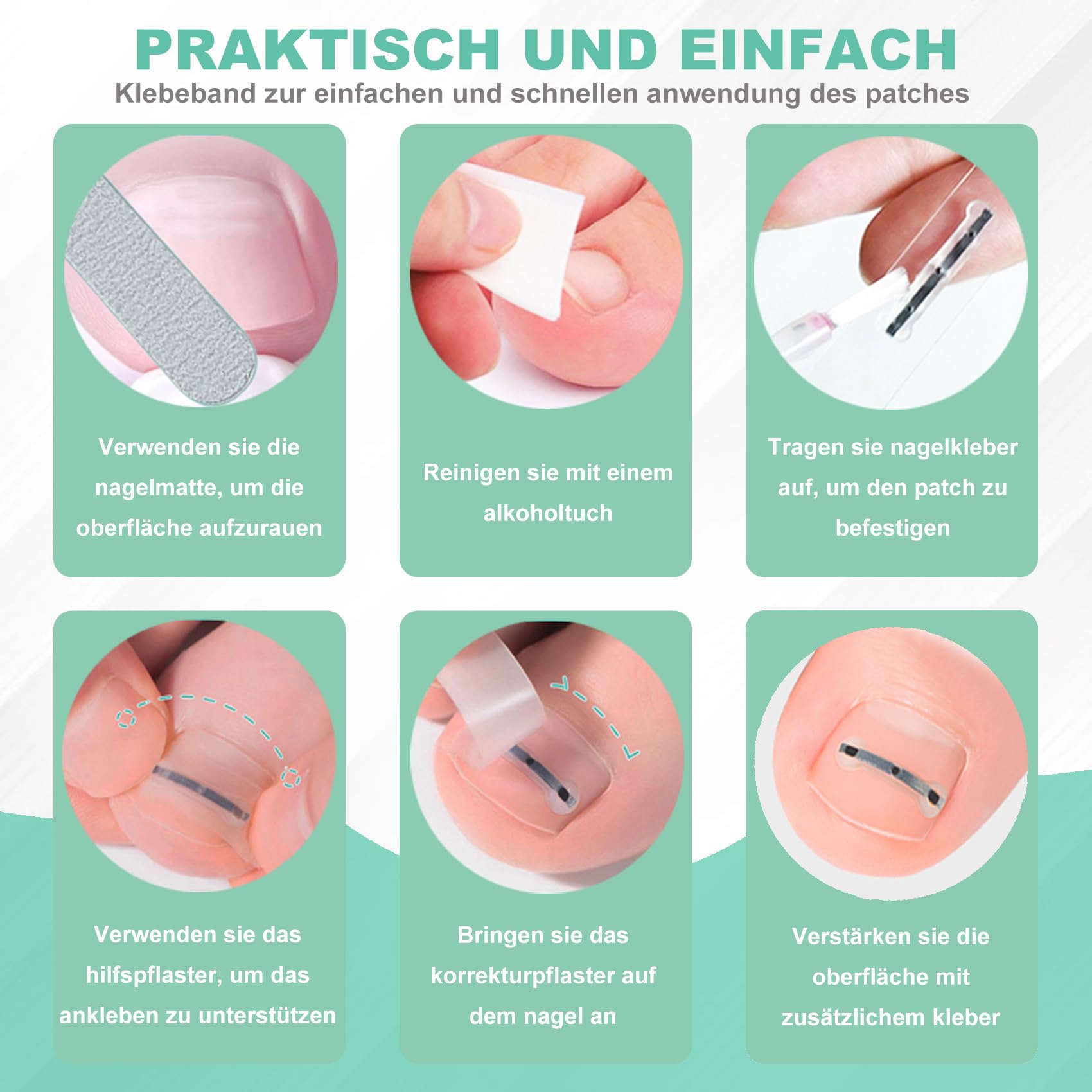 Eingewachsene Zehennägel Set Zehennagel Korrektur Patch 9pcs Nagelspange Fußnägel Zehennagelheber Werkzeugset für Paronychie Zehennagel Eingewachsen Reparatur, 0.59/0.67/0.79in