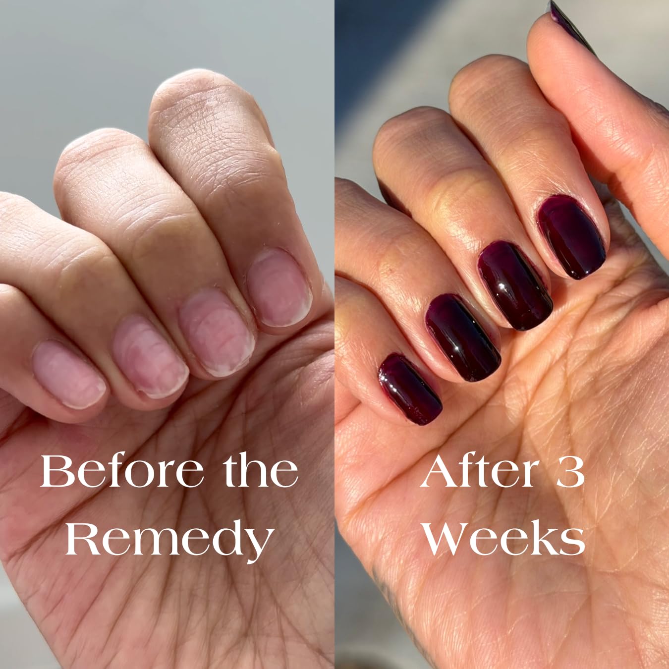 Botanist Nail Rescue Kit | Nail Strengthening Polish + Growth Serum | Grow and Strengthen Damaged Nails | Non-Toxic, 84% Plant Based, 21-Free & Vegan (Cherry Mocha) - Image 4