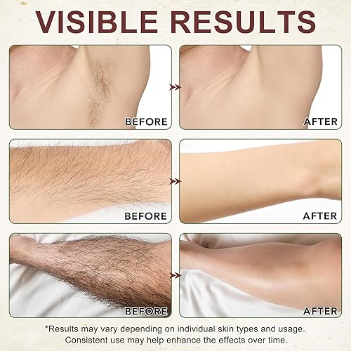 Miniatura 6 de Paquete de 2 aceites Cyperus Rotundus para depilación, natural para reducir el crecimiento del vello corporal, reducir el crecimiento del vello