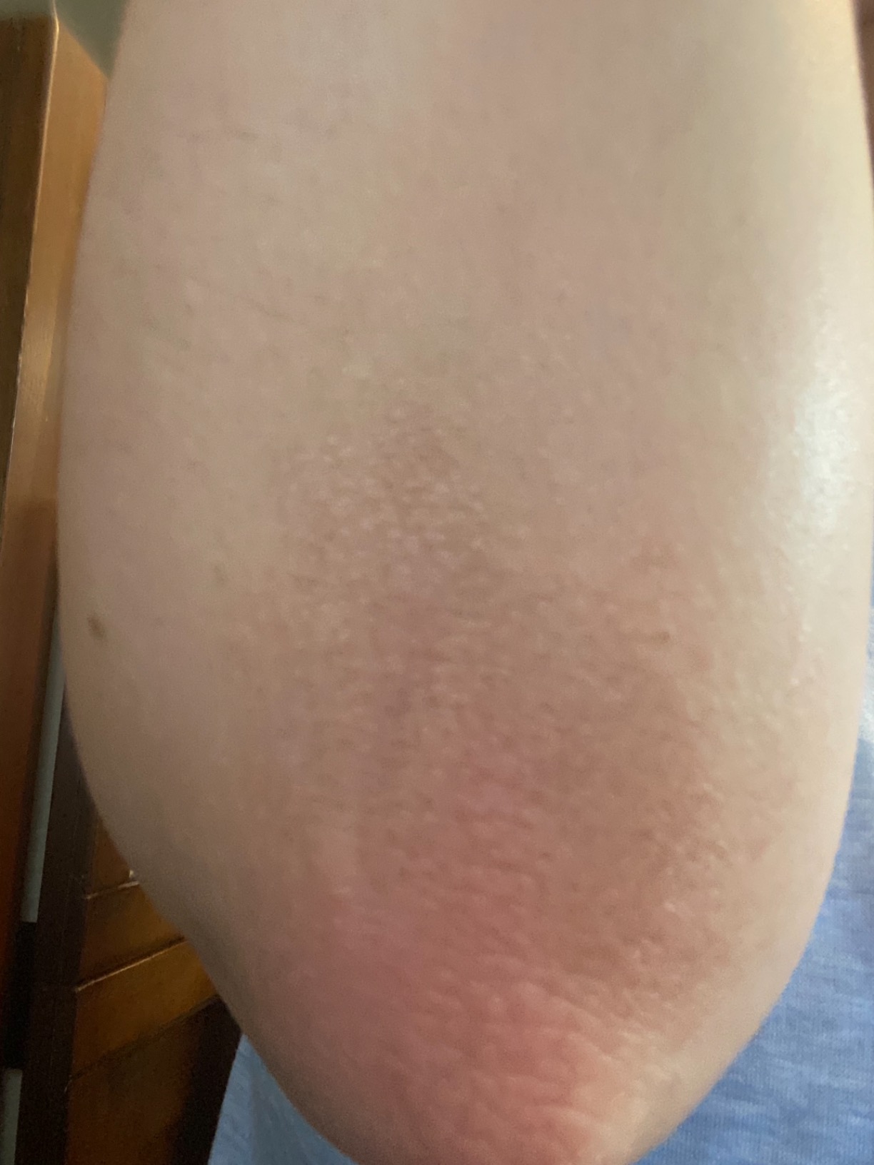 I can’t recommend this enough!!!