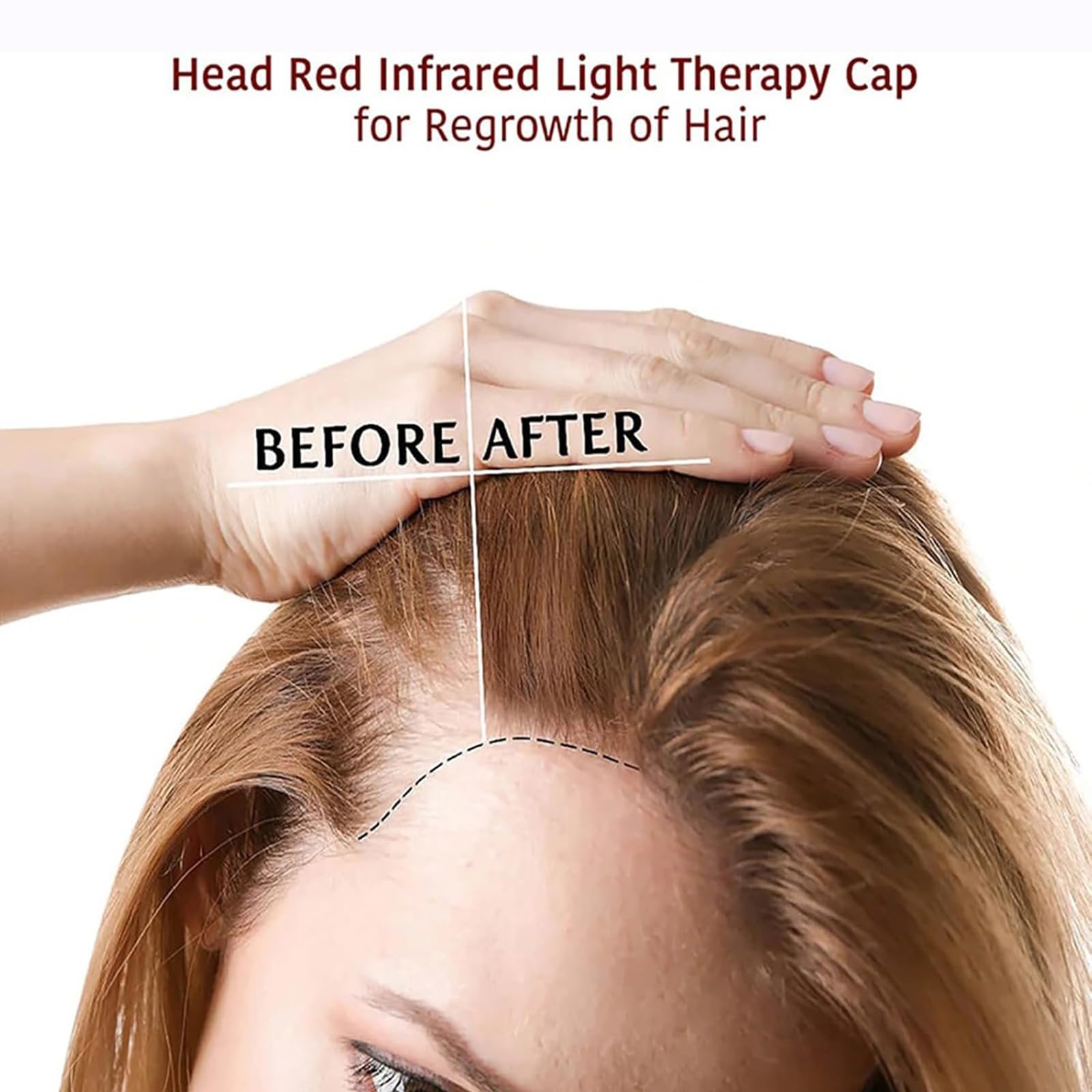 Gorro de terapia de luz roja, 215 LED de 660 Nm y 850 Nm Dispositivo de terapia con LED de infrarrojo cercano con 5 niveles ajustables y temporizador de 5 a 30 minutos, para la pérdida de cabello