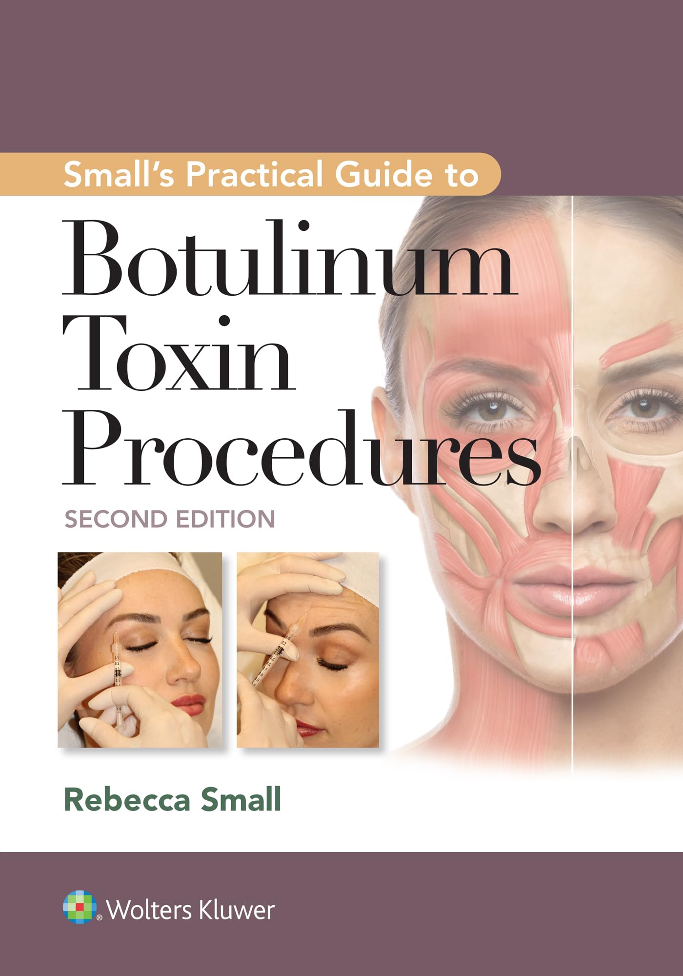 Small's Practical Guide to Botulinum Toxin Procedures (English Edition)