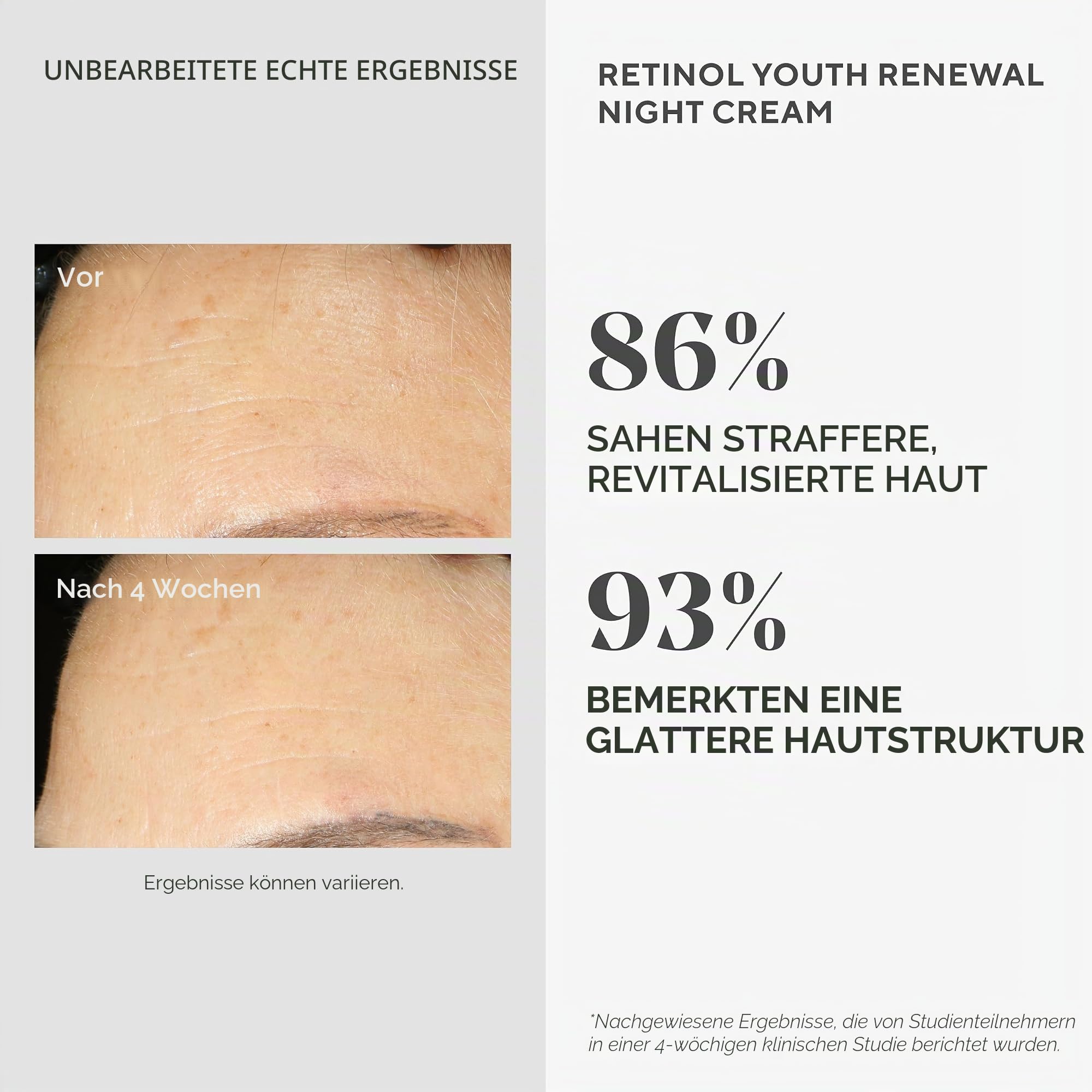 Murad - Anti-Aging Retinol Youth Renewal Night Cream 50 ml