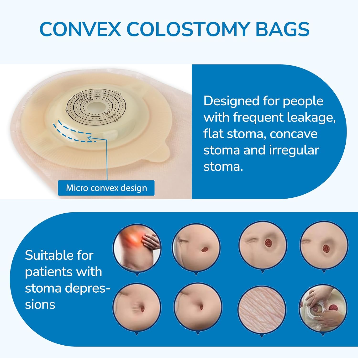10 PCS Colostomy Bags, Ostomy Supplies, One-Piece Convex Ostomy Bags with a Waistband for Uneven Skin/Deep-Seated Areas Stoma, Cut-to-Fit, Max 45 mm