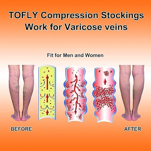 Miniatura 5 de TOFLY Manga de compresión de pantorrilla para hombres y mujeres, 1 par, calcetines de compresión sin pies de 20-30mmHg para soporte de piernas,