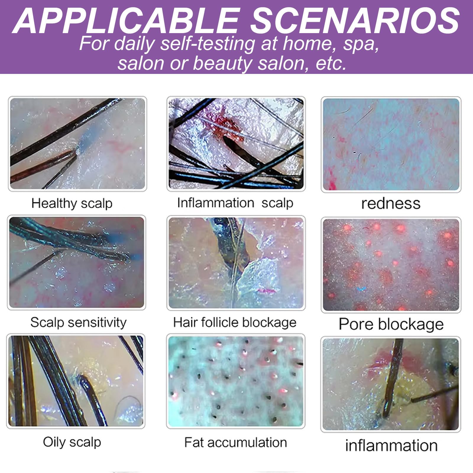 Dispositivo Para El Cuidado Del Cuero Cabelludo Con DeteccióN De Cabello De 200X, Con 5 Sondas Funcionales, MáQuinas De Terapia Capilar Con Pulverizador De Terapia De Calor EléCtrico, 30 X 37 X 36 Cm