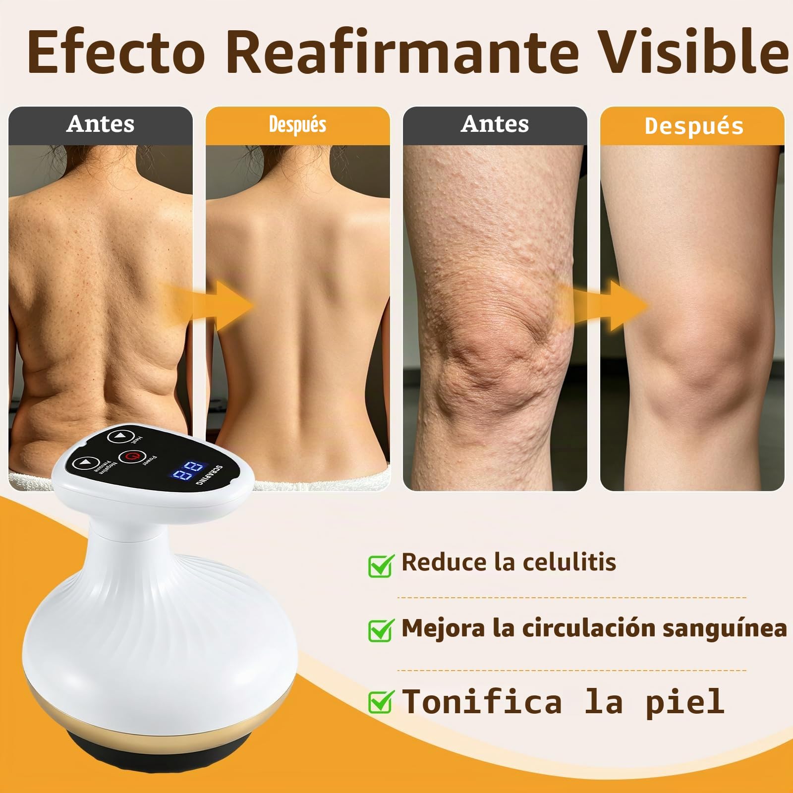 4en1 Masajeador GuaSha Anti Celulítico Eléctrico,Maquina Celulitis | con Luz Roja y Calor,Reduce la Apariencia de Celulitis,para Drenaje Linfático,Reafirmación de la Piel,Circulación Sanguínea