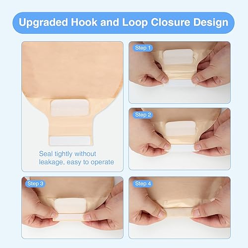Miniatura 6 de Paquete de 20 bolsas de colostomía para ostomía, bolsas grandes de 4.134 in para estoma grande y estoma doble, bolsas de ostomía drenables de una