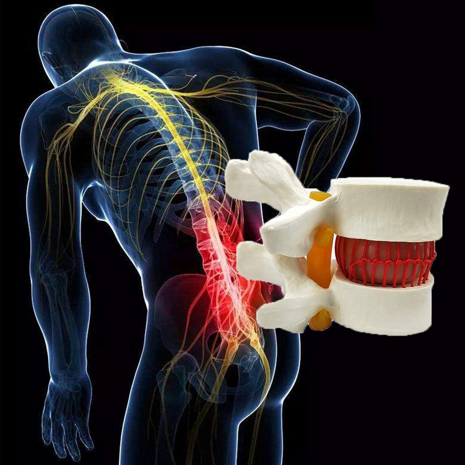 Modello di Dimostrazione del Disco Lombare Umano Modello della Colonna Sonora del Dorso Giallo Umano Colonna Lombare Anatomica Colonna Vertebrale Lombare