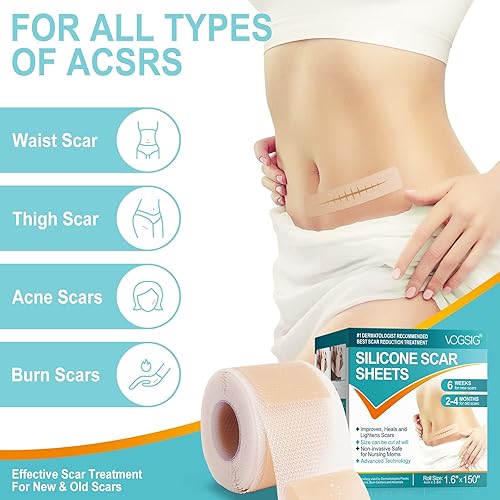 Miniatura 2 de Hojas de silicona para cicatrices (1.6 x 150 pulgadas - 3.8 M), cinta de silicona suave de grado médico, tiras, rollo - queloide, cesárea,