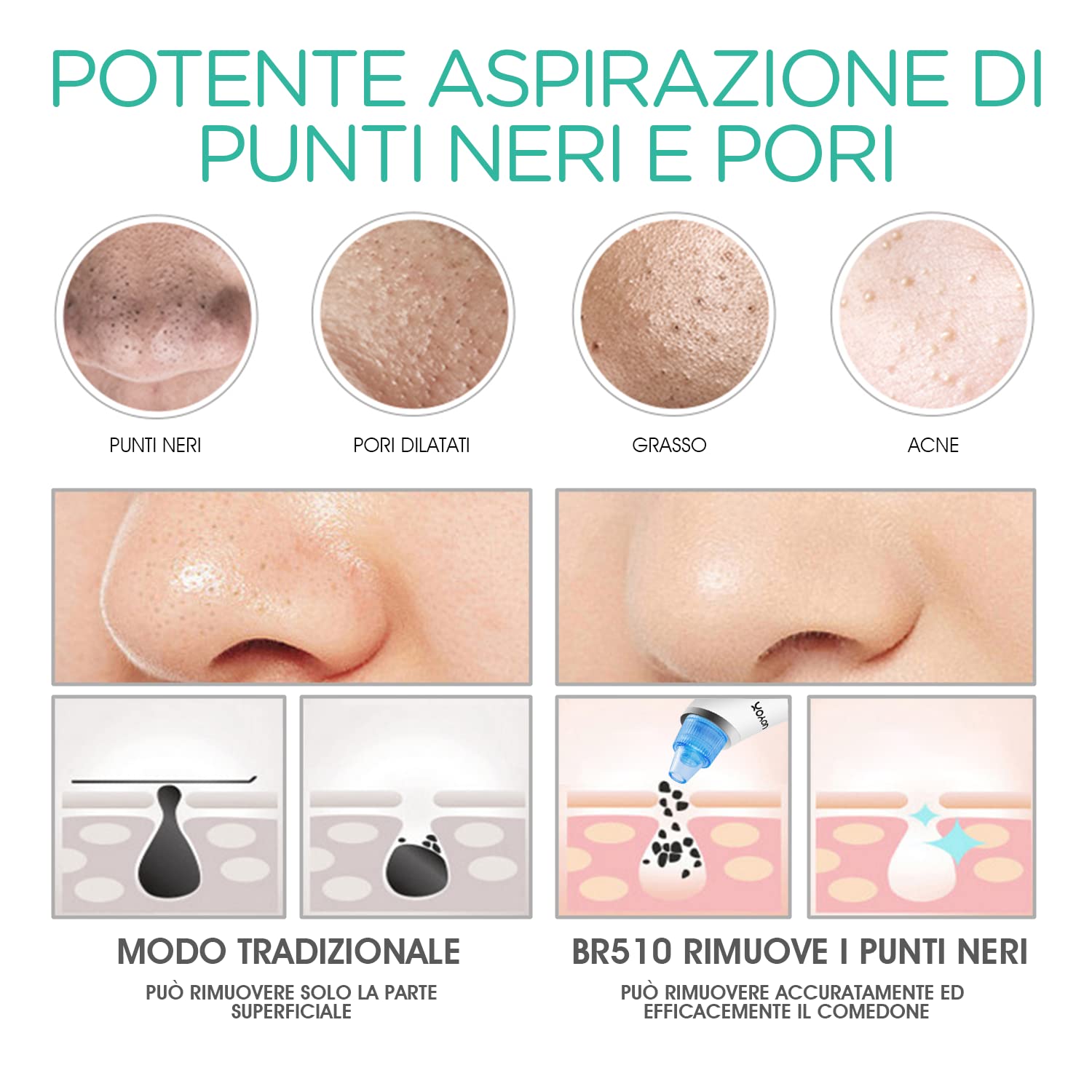 VOYOR Aspirapolvere punto nero professionale 6 in 1 estrattore di punti nero elettrico pneumatico comedoni acne detergente per pori cura viso donna, 6 sonde e 5 modalità, ricaricabile con display LCD