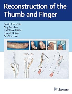Reconstruction of the Thumb and Finger