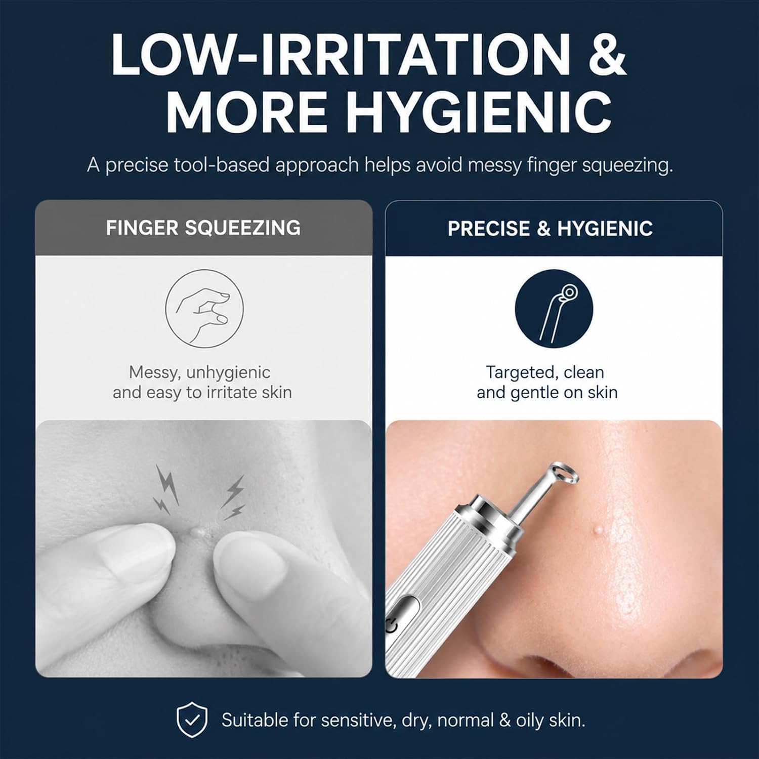 Visual Blackhead Remover with 50X 1080P Camera for iPhone/Android | 50X1080P, Pimple Popper, Blackhead Extractor, Acne Comedone Whitehead Removal, Home Pore Cleaning Kits for iPhone/Android