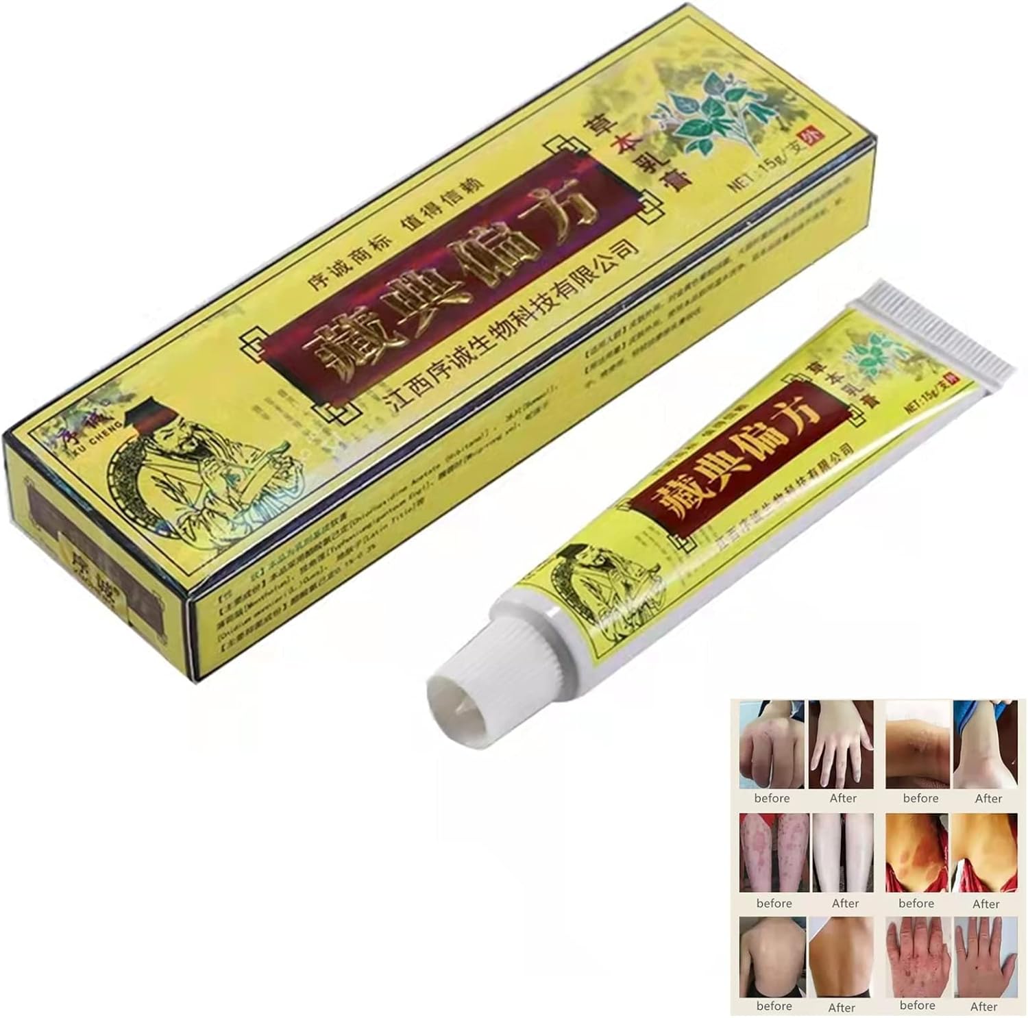 Natural Chinese Herbal Eczema Psoriasis Cream Dermatitis Pruritus Ointment External AntiItch
