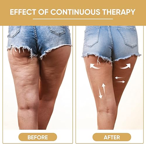 Miniatura 5 de ONUEMP - 2 herramientas de masaje para terapia de madera rodillo masajeador de madera y copa Gua Sha kit de Maderoterapia Colombiana para drenaje