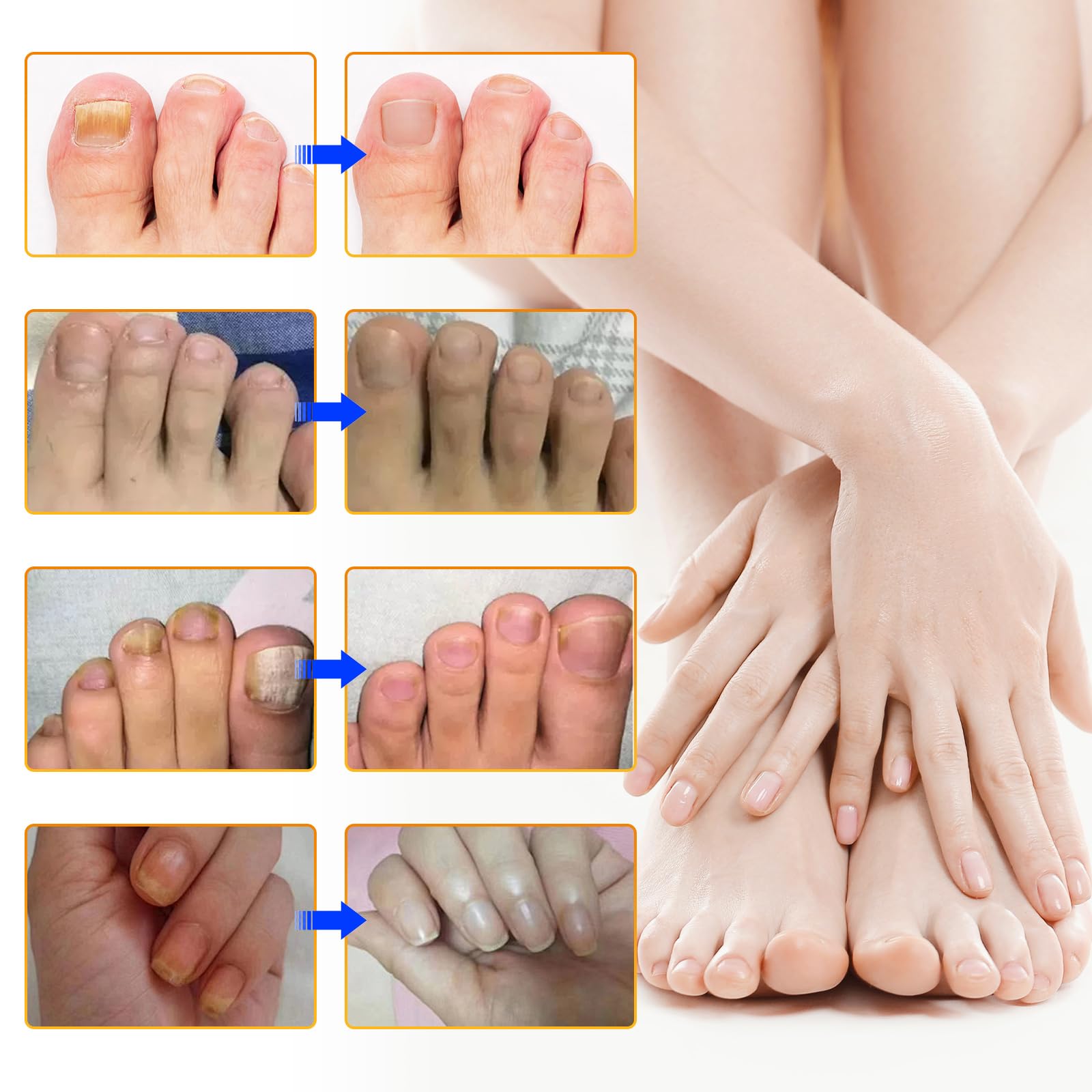 Il programma per la cura delle unghie, 24 scolorimenti e pedicure ottenere e per otto ore di cura delle unghie notturne, impermeabile