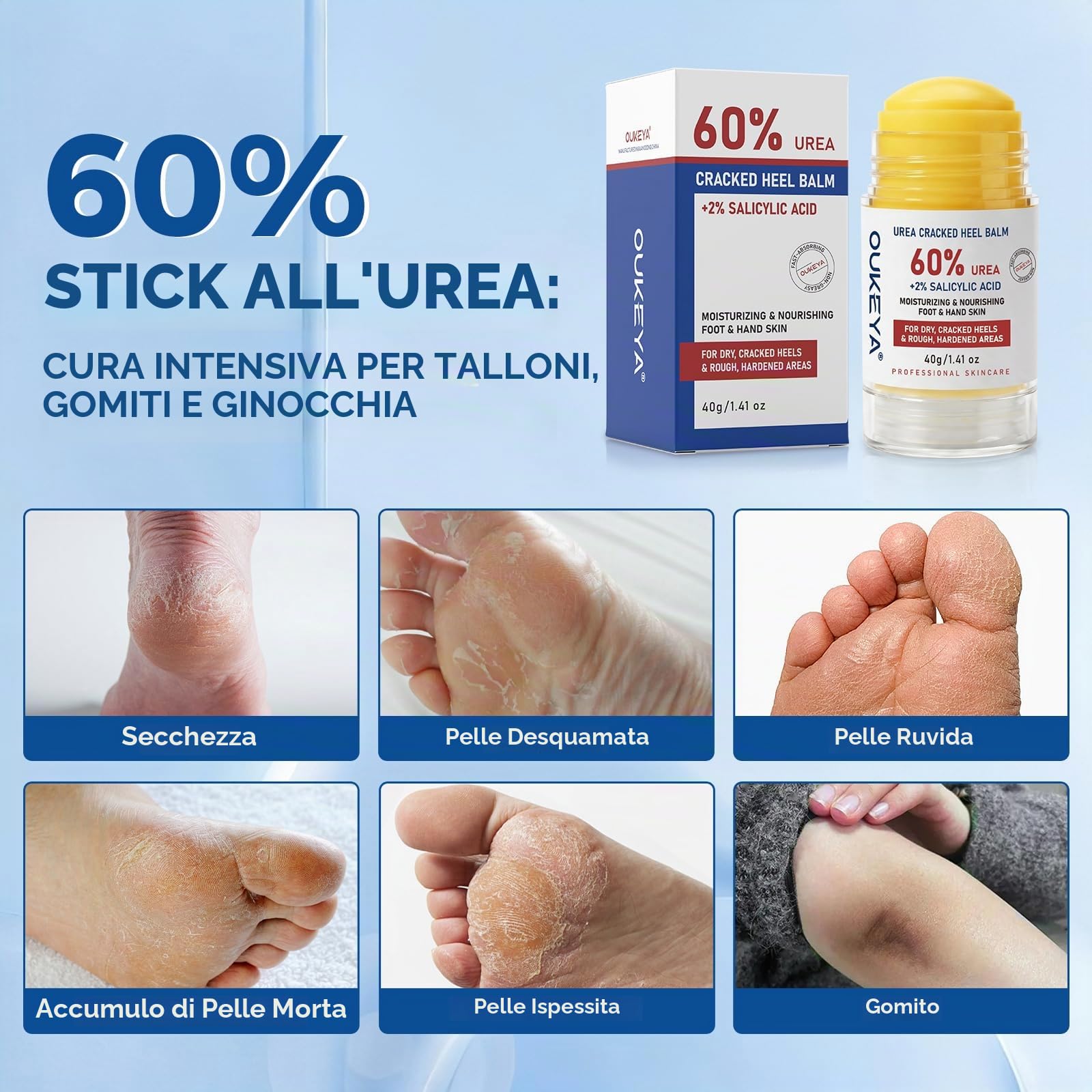 OUKEYA Stick Anti-Callosità con 60% Urea & 2% SA, Balsamo Solido Ammorbidente per Talloni, Piedi, Gomiti e Ginocchia, Cura Intensiva per Pelle Secca e Ruvida, 40 g