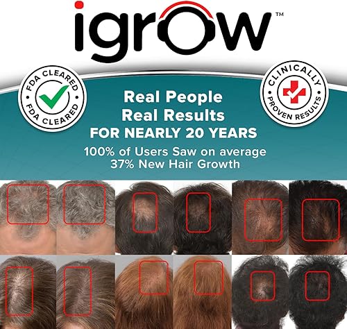 Miniatura 2 de iGrow Sistema profesional de crecimiento del cabello láser - Gorra láser aprobada por la FDA para el crecimiento del cabello para hombres y