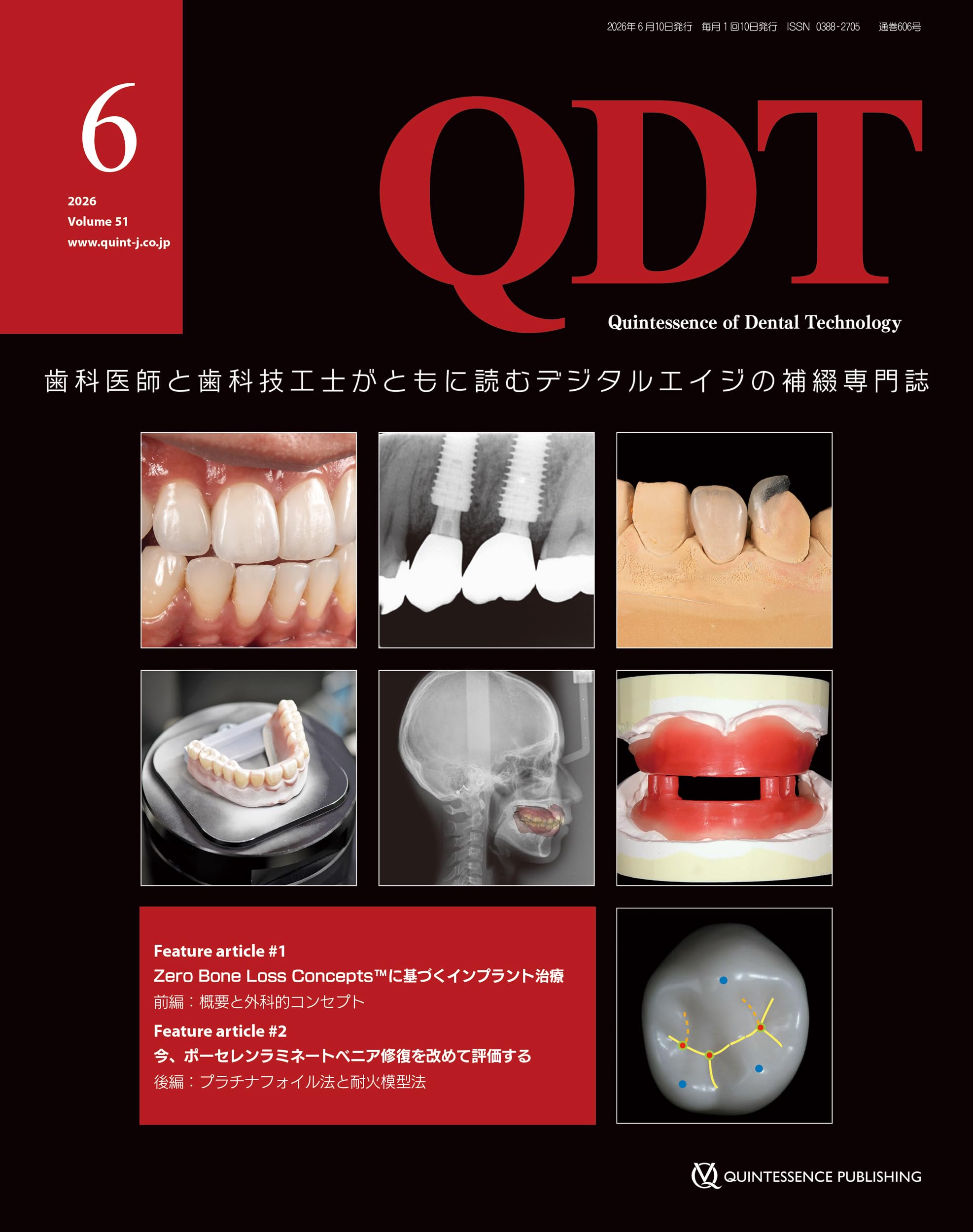 QDT 2026年6月号: 歯科医師と歯科技工士がともに読むデジタルエイジの