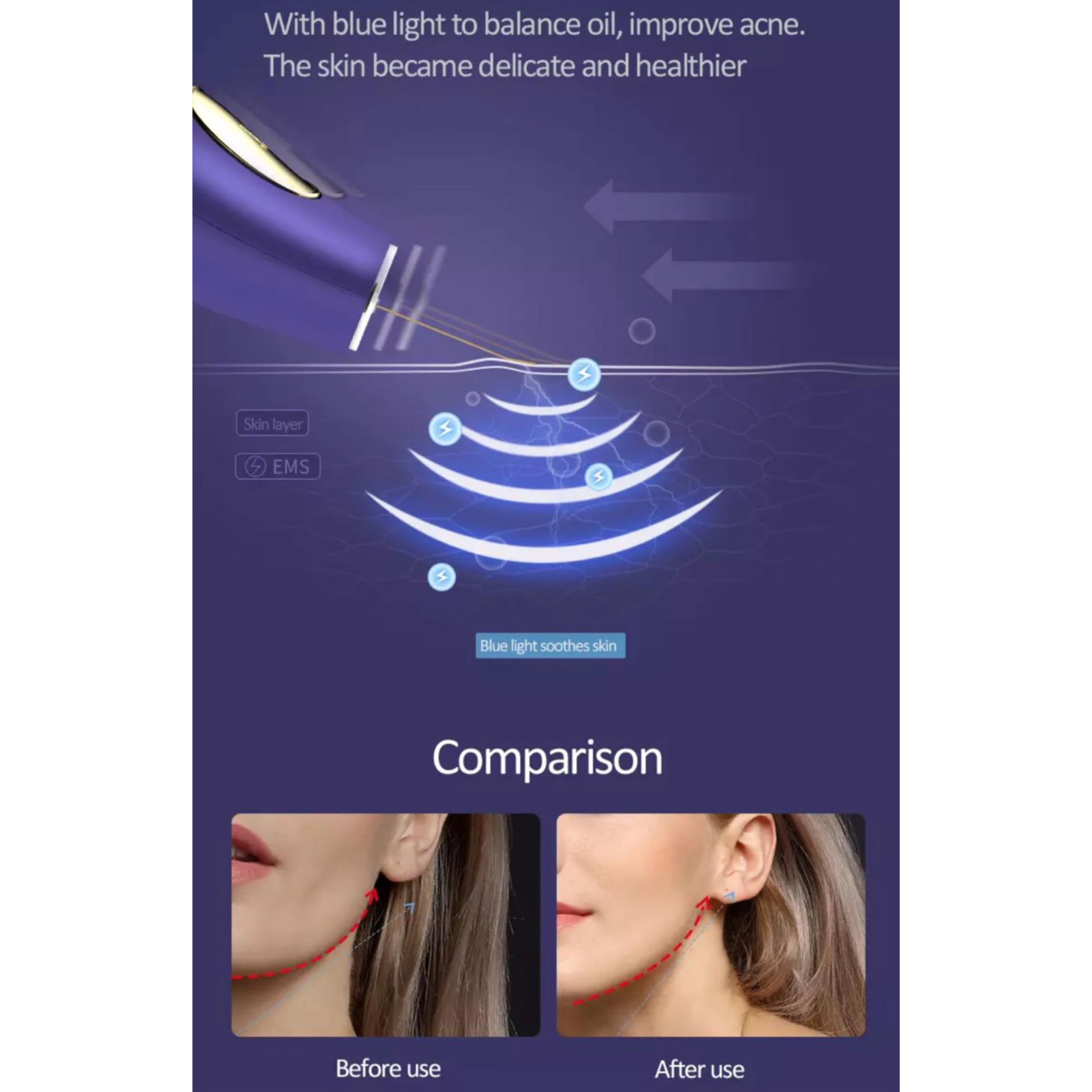 Lalano´S Cosmetics Golden Skin Scrubber - Pulitore per viso ad ultrasuoni, spatola dorata 24 K, EMS Lifting, tecnologia ionica, terapia a LED, rimozione punti neri e pulitore per pori, senza fili