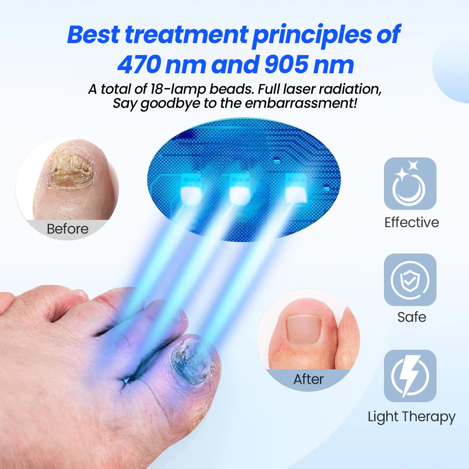 Appareil Laser Traitement Mycose Ongles - Luminothérapie LED - NEUF - Marque QUATTRO