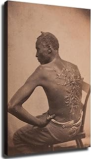 Wall Art Canvas Prints- Pictures of whipping scars on slaves, African American slavery Posters Room Aesthetics-Best decoration for kitchen living room bedroom office gym etc (08x12inch-Unframed)