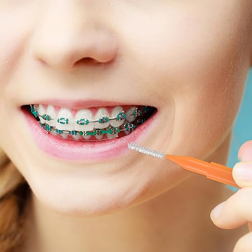 Miniatura 3 de LALAFINA 100 piezas limpiador interdental cepillo limpiador de dientes, llaves limpiadoras para aparatos ortopédicos, cepillo limpiador de cepillos