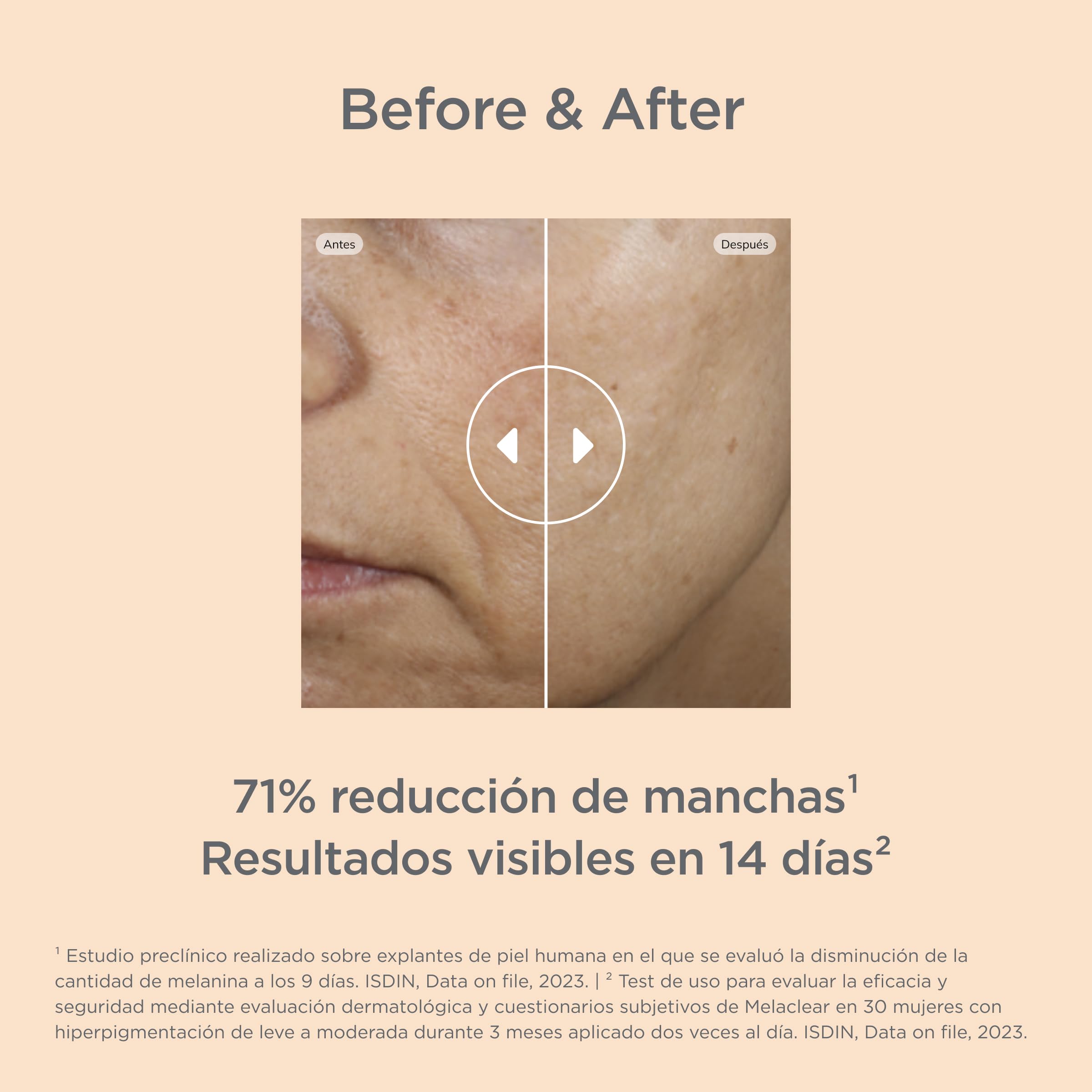 ISIDN Isdinceutics Melaclear Sérum Antimanchas con Ácido Tranexámico y Niacinamida, Reduce las Manchas de la Piel Rápidamente, 1,8% 30 ml