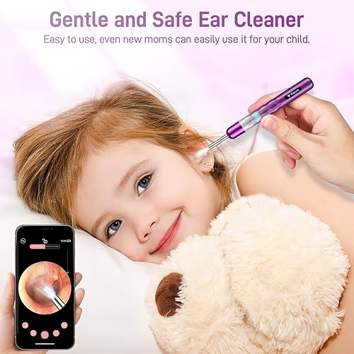 Miniatura 2 de Eliminación de cera de oído, cámara de oído con 1440P HD, limpiador de oídos con cámara WiFi integrada, kit de eliminación de cera con 6 púas de