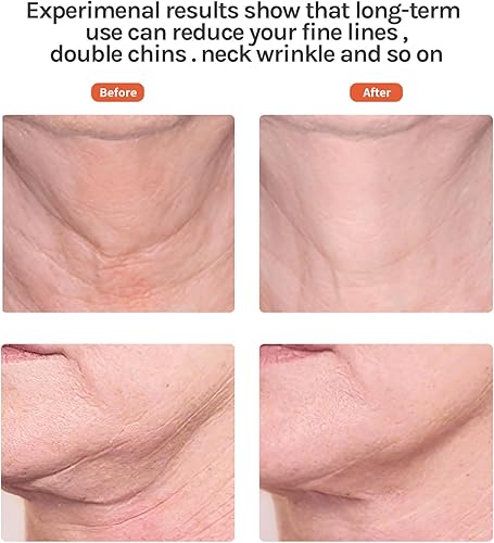 Miniatura 6 de Red Light Facial Massager, Skin Care Tools for Face & Neck Beauty Device, 3 in 1 Face Massager Tool with LED, Thermal, Vibration, Tightenings, Verde