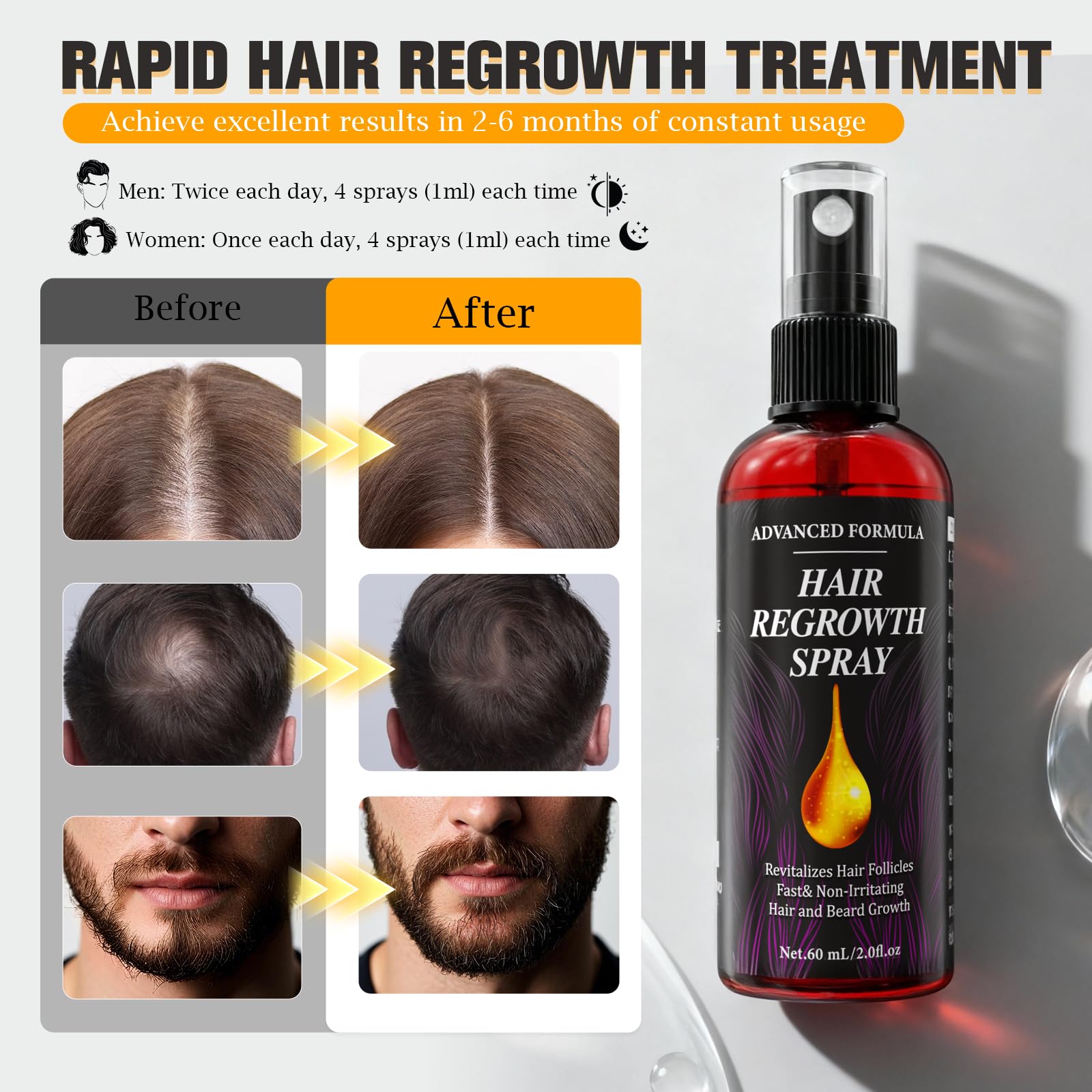 Hair Growth Serum Spray 3×60ml – Rosmarinöl, Rizinusöl & Biotin | Haarserum gegen Haarausfall für Männer & Frauen | Bartwuchs Beschleunigen | Natürliche Kopfhaut Haarpflege Set