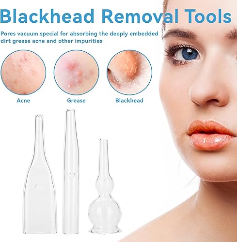 Miniatura 2 de Kit de tubo de vidrio al vacío, 3 piezas, eliminación de puntos negros, succión facial, aspiradora de poros para limpiador facial, máquina de