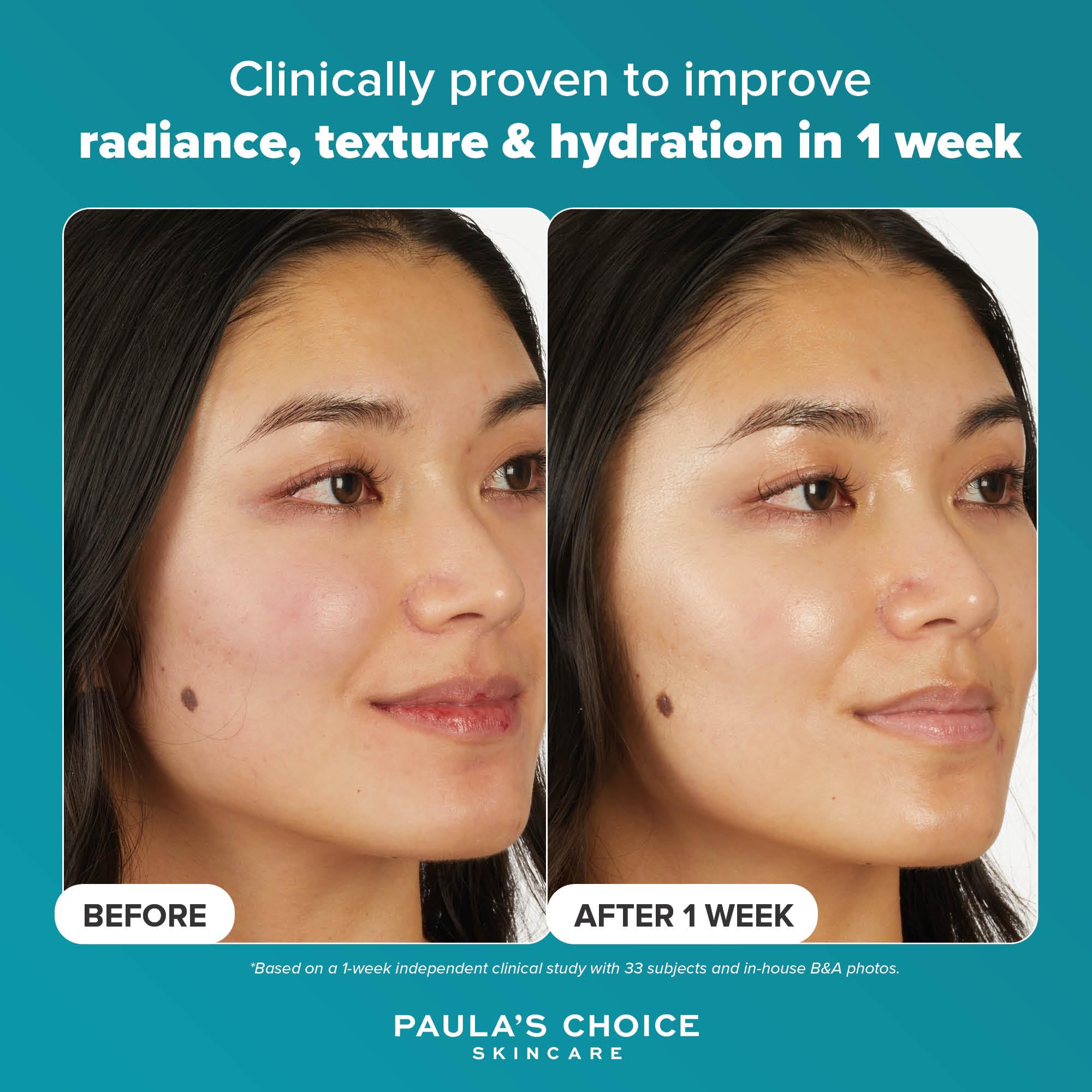Paula's Choice 7% Ectoin & Hyaluronic Acid Milky Hydrating Serum - Serum do Twarzy - Natychmiastowe Nawilżenie - Koi, Redukuje Zaczerwienienia - z Kwas Hialuronowy - Wszystkie Rodzaje Skóry - 20 ml