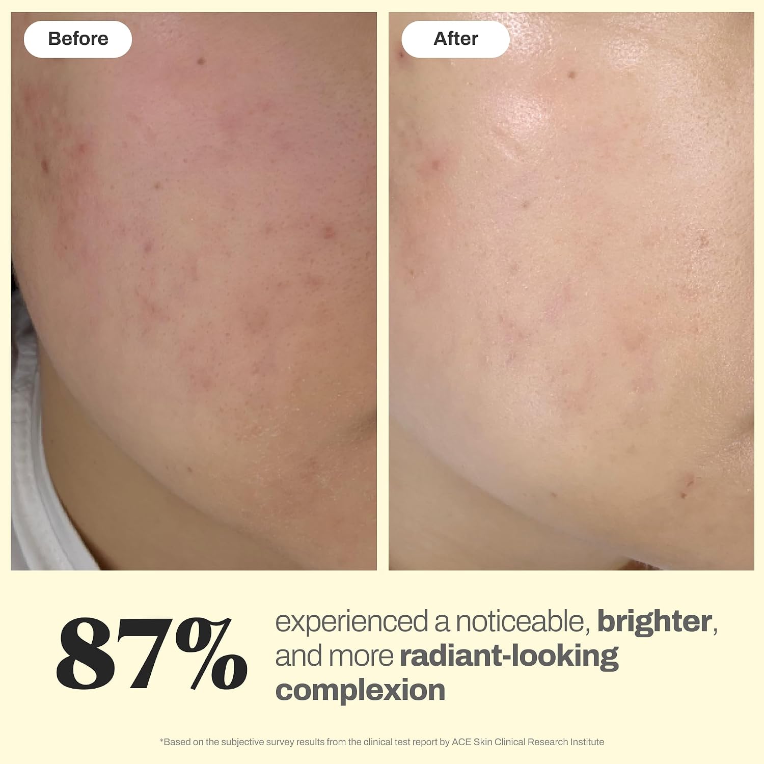 Brightening Glow Essence - Lightweight K Beauty Essence with Niacinamide, Tranexamic Acid, Glutathione, Cica & Panthenol for Sensitive Oily Blemish-Prone Skin - 1.01 Fl Oz