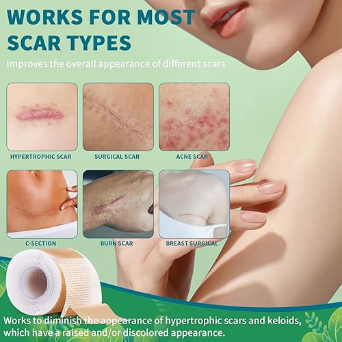 Miniatura 2 de Paquete de 2 hojas de silicona para cicatrices, cinta de cicatriz de silicona, hojas de cicatrices para cicatrices quirúrgicas, tiras de cicatrices
