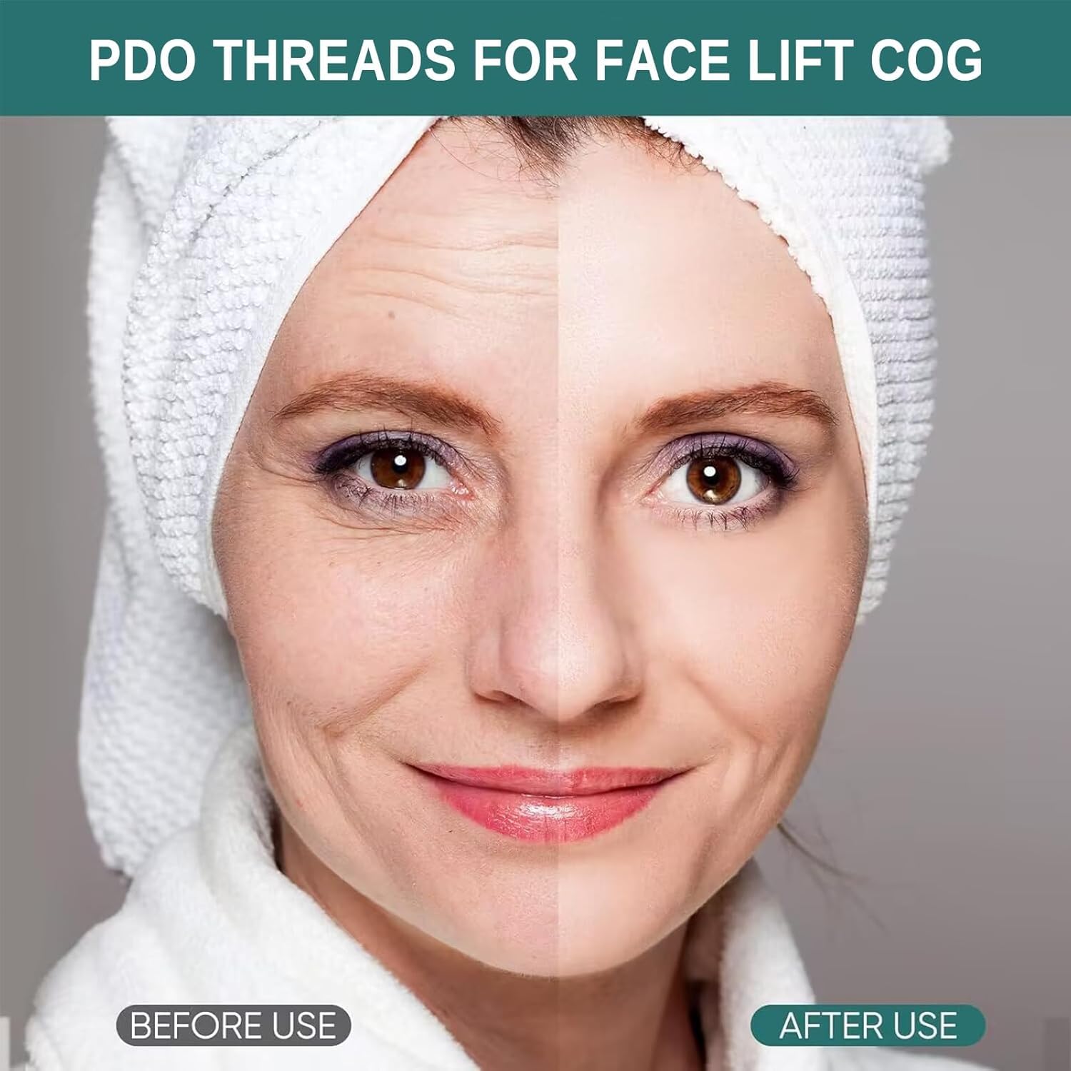 Fili PDO per ingranaggi Facelifting 18G 100mm 20 sztuk