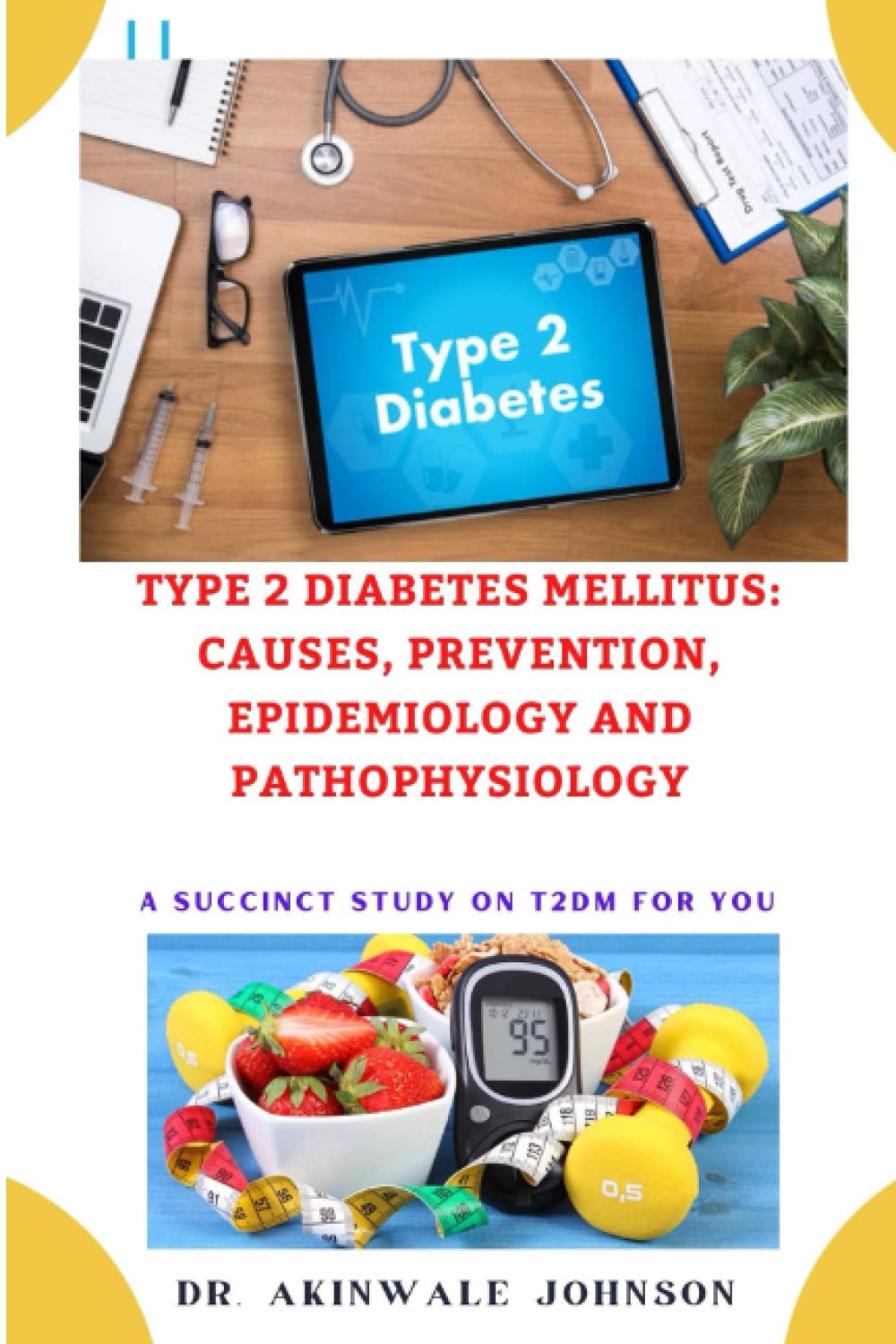 Type 2 Diabetes Mellitus: Causes, Prevention, Epidemiology and Pathophysiology: An Exclusive and Succinct Study on Type 2 Diabetes Mellitus