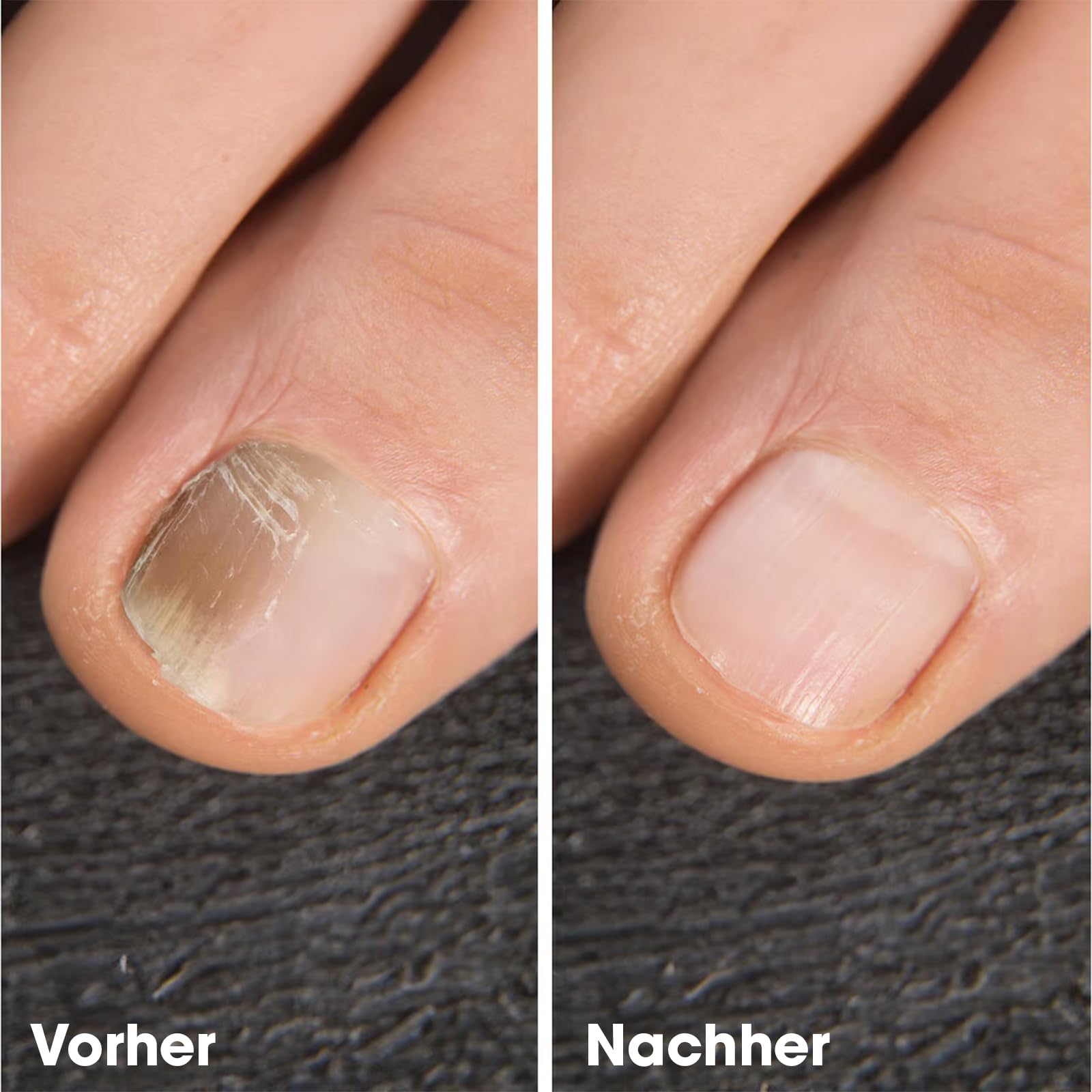 IZA Effect - Fußpflegespray 2x 100ml - Fuß Spray zur täglichen Pflege, pflegt Haut & Nägel - Fuß Hygiene Spray für Frische & Hygiene, unterstützt gesundes Fußklima - einfache Anwendung ohne Auswaschen