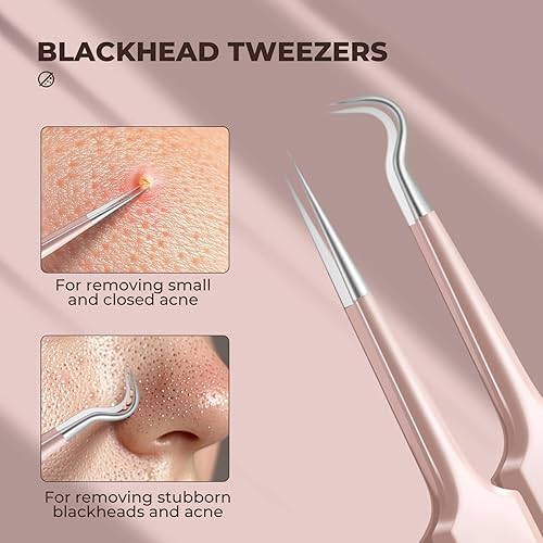 Miniatura 2 de Pinzas profesionales para puntos negros, herramientas de eliminación de puntos negros de acero inoxidable, kit de herramientas para eliminar manchas