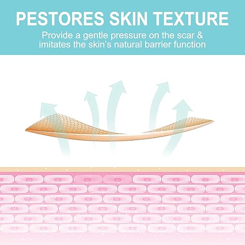 Miniatura 6 de Hojas de silicona para cicatrices (1.6 x 150 pulgadas - 3.8 M), cinta de silicona suave de grado médico, tiras de cicatrices, rollo de cicatrices,