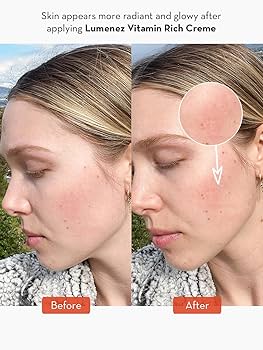 Amazon.com: SONAGE Lumenez Vitamin Facial Cream: Daily Restorative