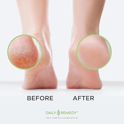 Miniatura 36 de Aceite de árbol de té para pies con sal de Epsom, fabricado en Estados Unidos, 16 onzas