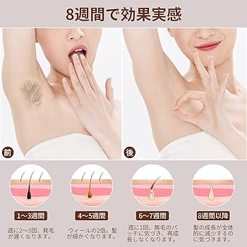 Amazon | CEENBOO®︎ 脱毛器 レーザー サファイア鏡面 氷点脱毛